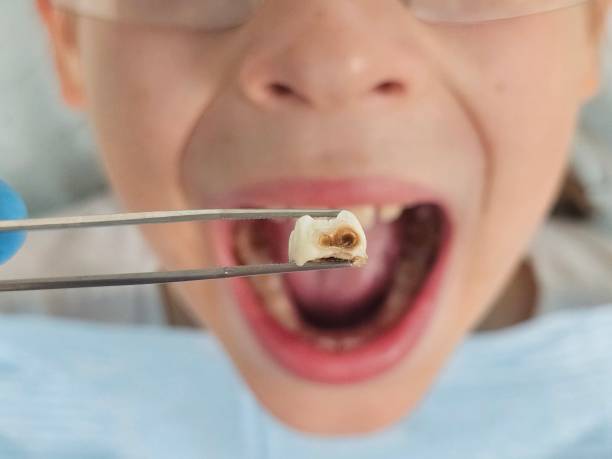 Best After-Hours Dental Trauma Care in Trenton, OH