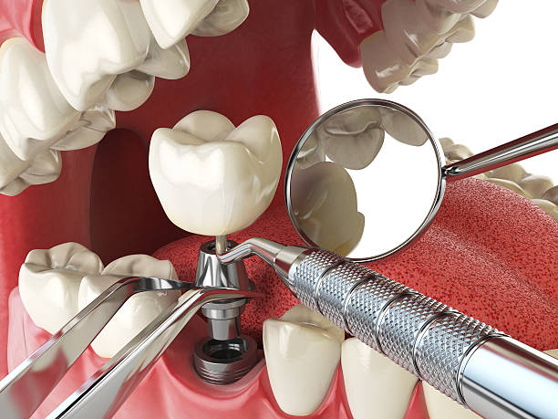 Best Cosmetic Emergency Dentistry in Trenton, OH